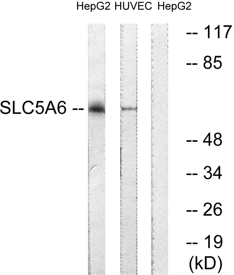 SLC5A6 / SMVT Antibody (aa551-600)
