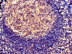 SERPING1 / C1 Inhibitor Antibody