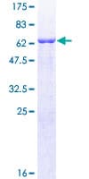 Human CRELD2 Protein (Recombinant GST)