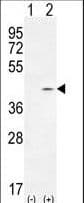 TWF2 / PTK9L Antibody (aa28-57)
