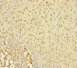 Polyclonal Rabbit anti-Human YME1L1 Antibody (IHC, WB)