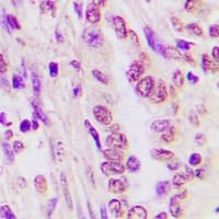 C/EBP Alpha / CEBPA Antibody