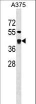 Polyclonal Rabbit anti-Human SDSL / Serine Dehydratase-Like Antibody (aa1-30, WB)