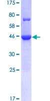 Human CCDC117 Protein (Recombinant GST)