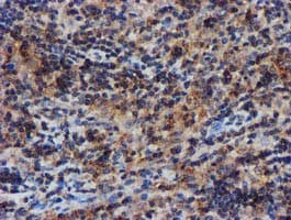 Complement C1s Antibody (clone OTI4E3)