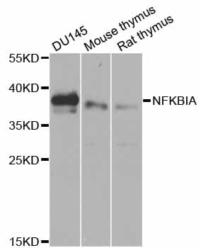 Polyclonal Rabbit anti-Human NFKBIA / IKB Alpha / IKBA Antibody (IHC, IF, WB)