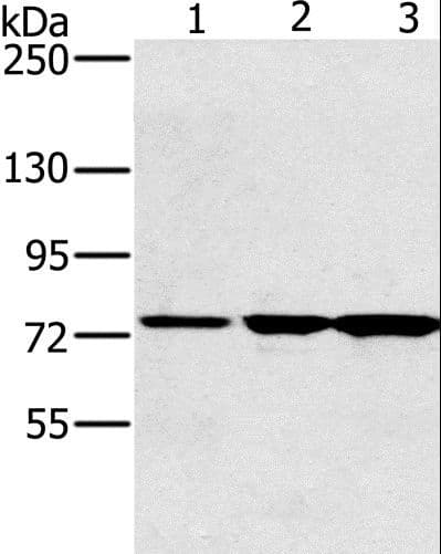 KIRREL2 / FILTRIN Antibody