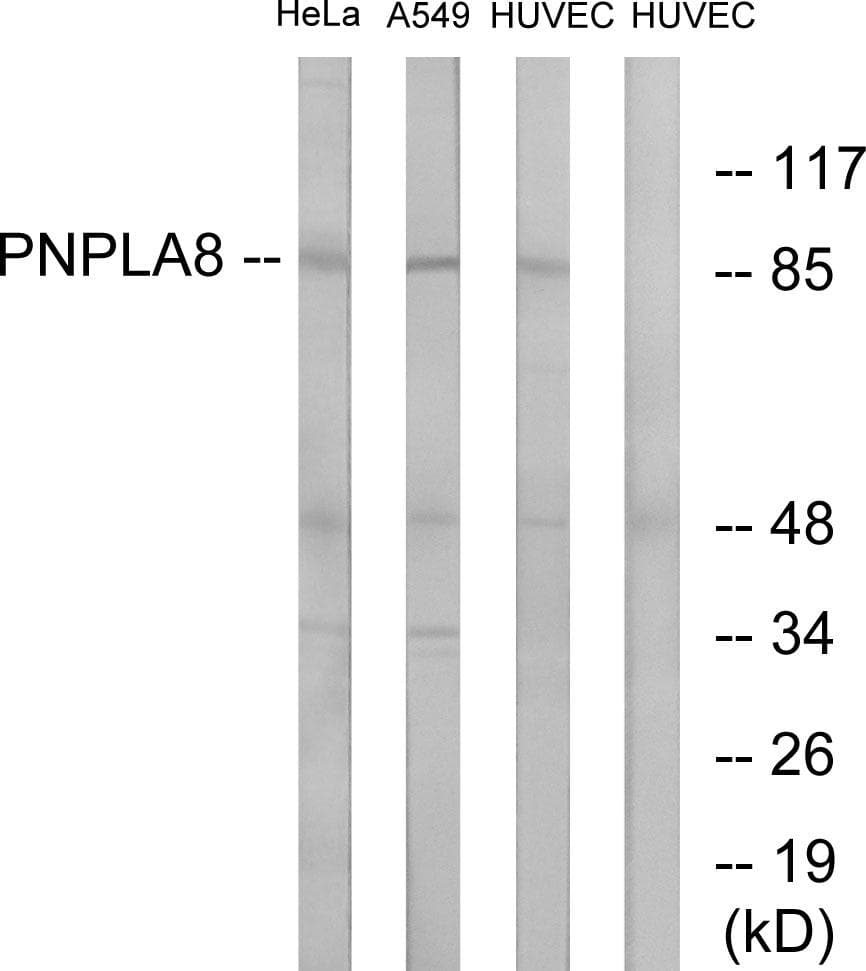 PNPLA8 Antibody