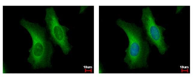 Polyclonal Rabbit anti-Human SERPINB6 / PI-6 Antibody (aa66-313, IHC, WB)