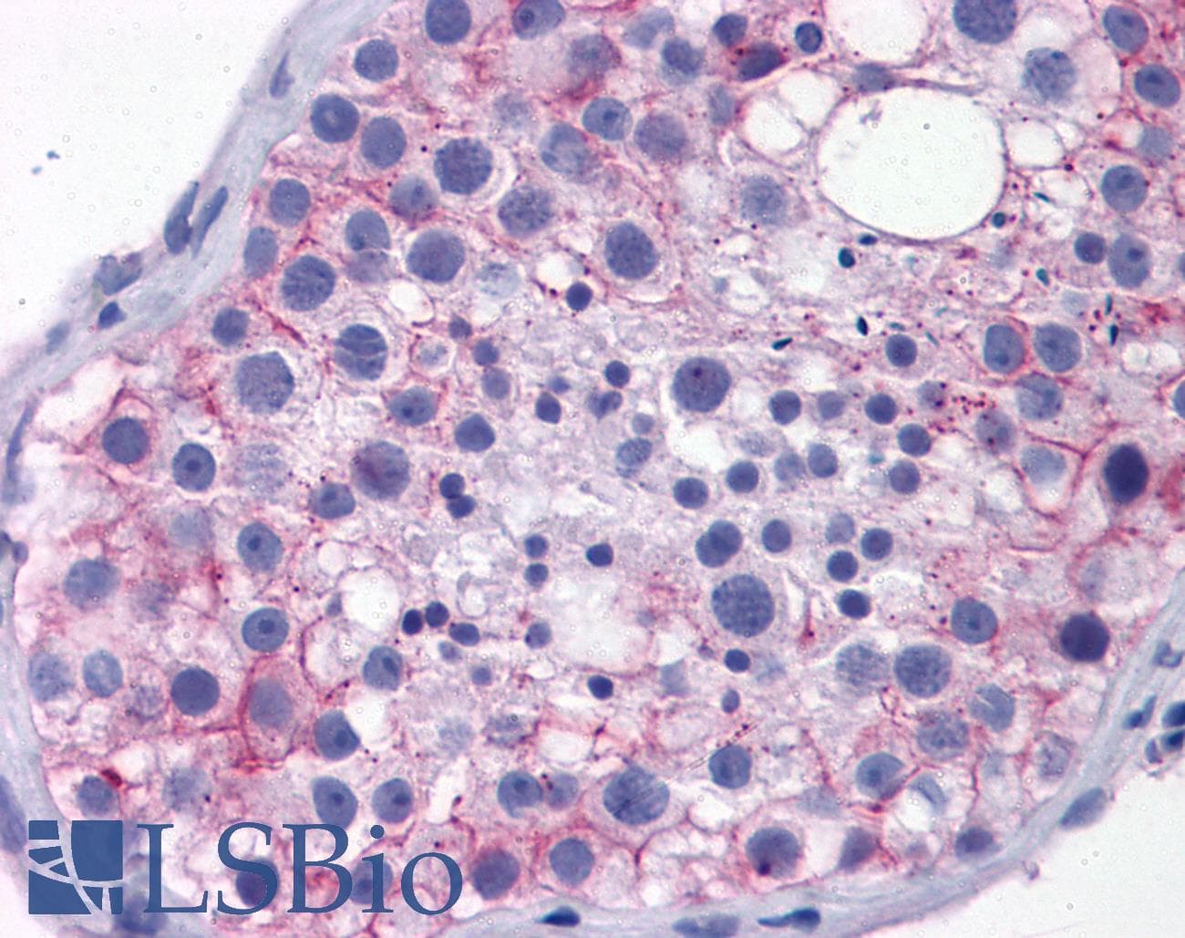 PathPlus™ TJP1 / ZO-1 Antibody (aa935-984)