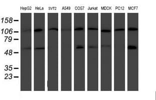 HARS2 Antibody (clone OTI5H2)