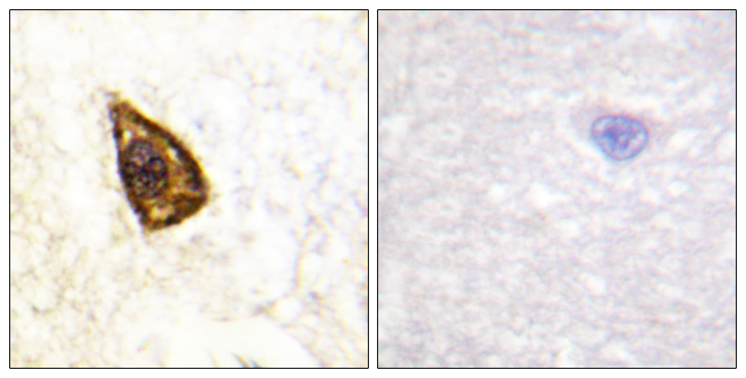 NTRK2 / TRKB Antibody (aa671-720)