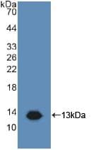 Polyclonal Rabbit anti-Human CD81 Antibody (aa113-201, WB)