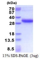 Human MREG Protein (Recombinant His)