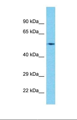 CIR1 Antibody (aa187-236)