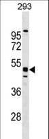 MTL5 / TESMIN Antibody (aa341-368)