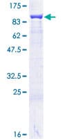 Human HSPA9 / Mortalin / GRP75 Protein (Recombinant GST)