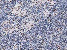 MSI1 / Musashi 1 Antibody (clone OTI3G4)