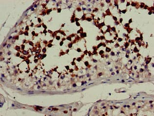 CYP51A1 / CYP51 Antibody