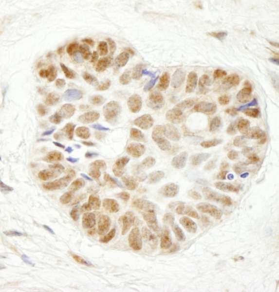 TCAB1 / WDR79 Antibody (aa1-50)