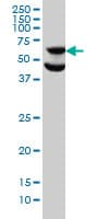 IHC-plus™ RPS6KB1 / P70S6K / S6K Antibody (clone 1E12)