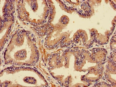 PSMB4 Antibody