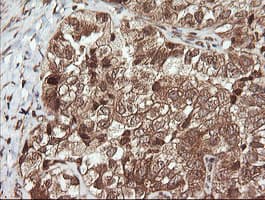 UBE2G2 Antibody (clone OTI4E12)