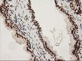 LOX / Lysyl Oxidase Antibody (clone OTI9G2)