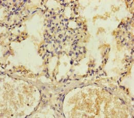 KIZ / PLK1S1 Antibody