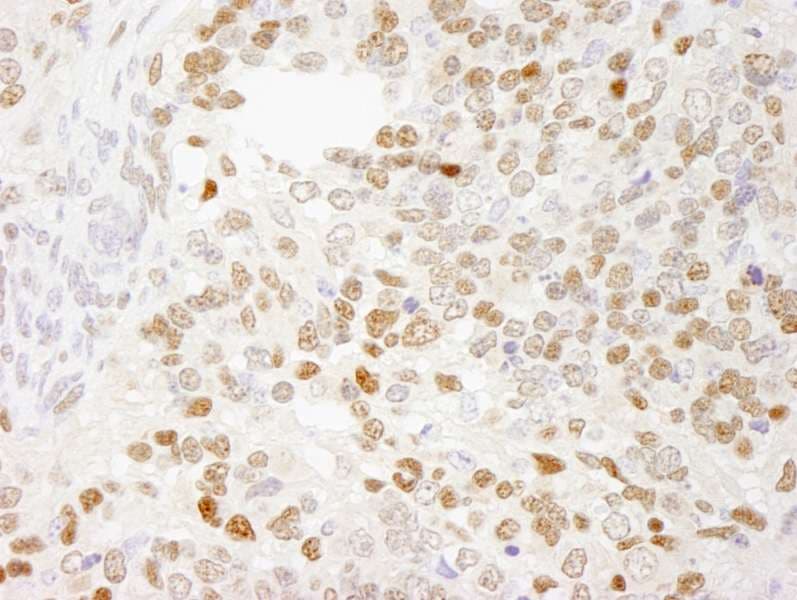 Polyclonal Rabbit anti-Human ZEB1 / AREB6 Antibody (aa1074-1124, IHC)