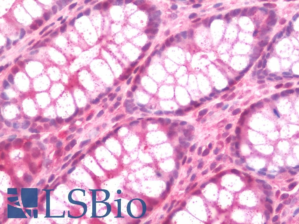 IHC-plus™ Polyclonal Rabbit anti-Human STUB1 / CHIP Antibody (IHC, WB)