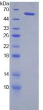Rat NRP2 / Neuropilin 2 Protein (Recombinant His-GST)