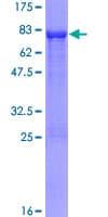 Human UGP2 Protein (Recombinant GST)