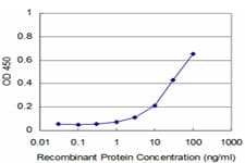 Monoclonal Mouse anti-Human NFKB1 / NF-Kappa-B Antibody (clone 4A11, IHC, IF, WB)