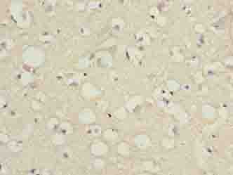 Polyclonal Rabbit anti-Human SLC6A6 / Taurine Transporter Antibody (IHC, WB)