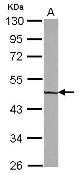 ZNF323 Antibody