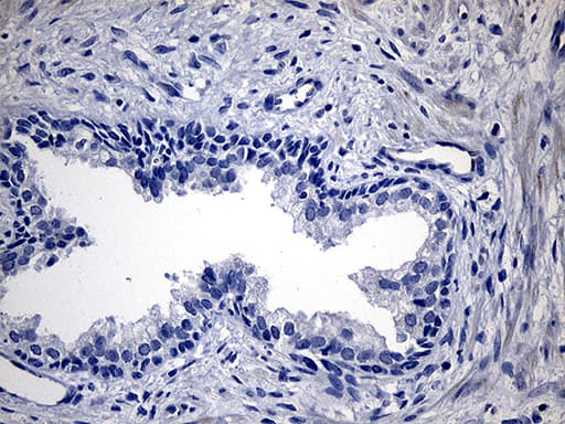 TG / Thyroglobulin Antibody (aa20-358, clone OTI8E1)