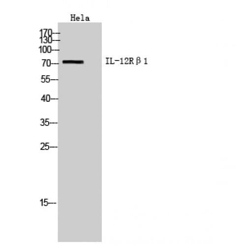 IL12RB1 / CD212 Antibody (211-260 aa, Internal)
