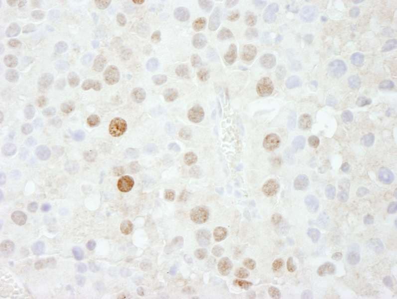 FOXK1 / MNF Antibody (aa683-733)
