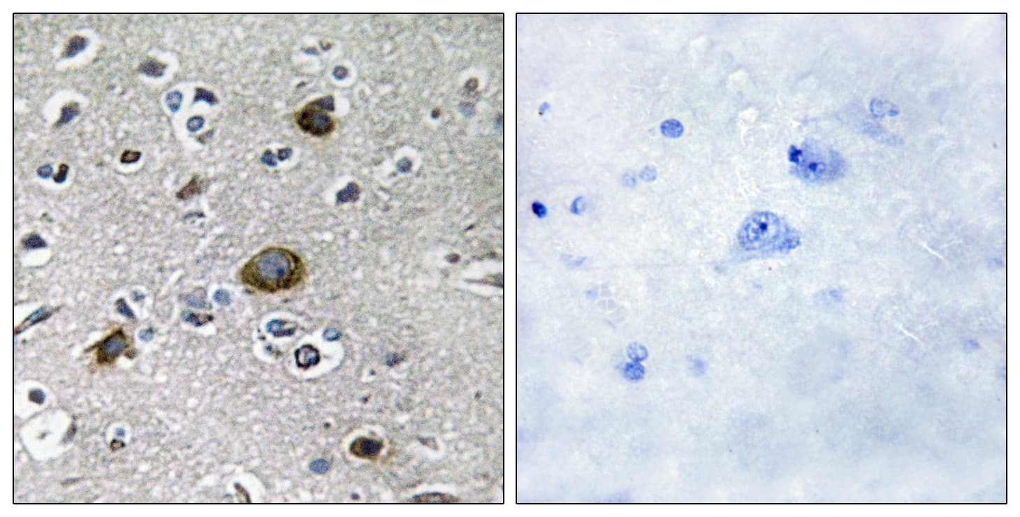 AKAP1 / AKAP Antibody (aa281-330)