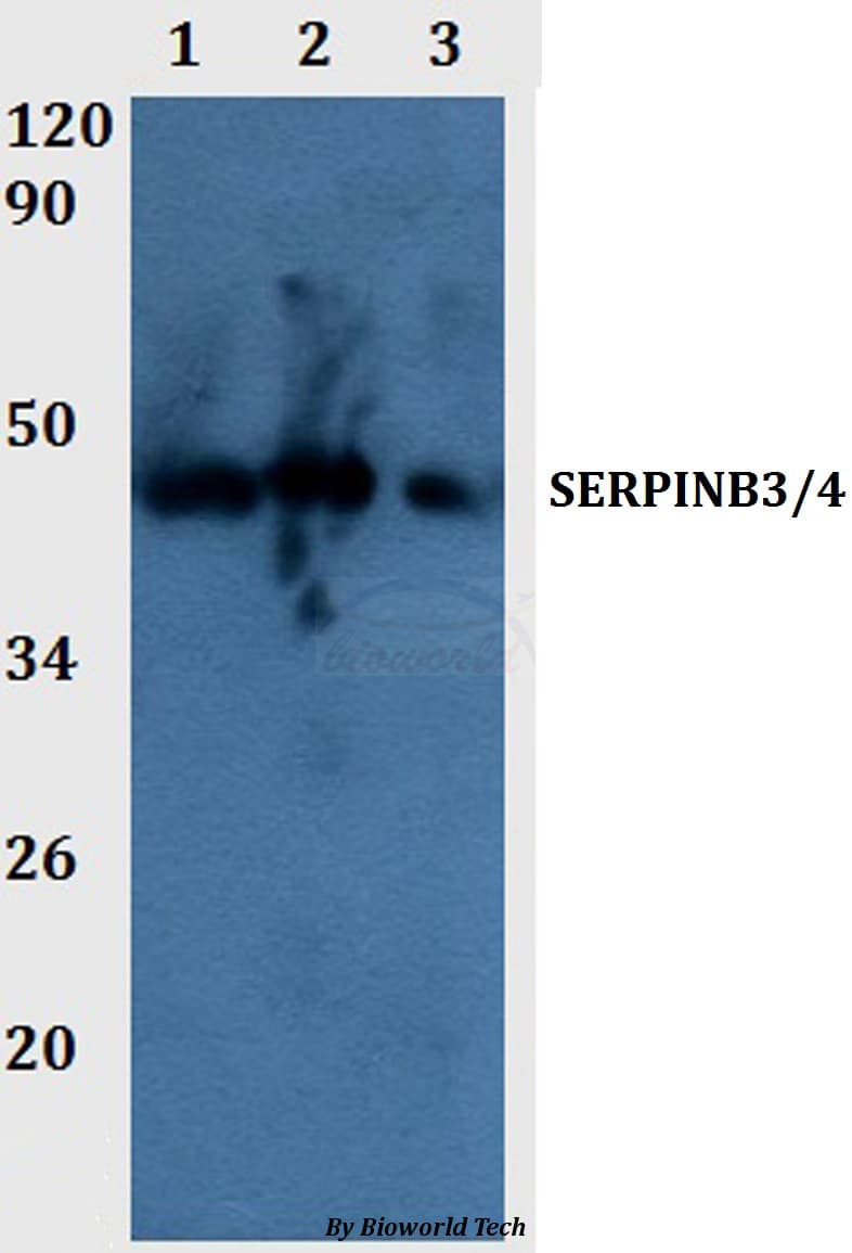 Polyclonal Rabbit anti-Human SERPINB3+4 Antibody (WB)