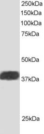 IHC-plus™ Polyclonal Goat anti-Human ALS2CR1 / NIF3L1 Antibody (aa365-377, IHC, WB)