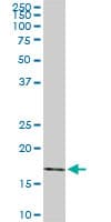 IHC-plus™ RHEB Antibody (clone 2C11)
