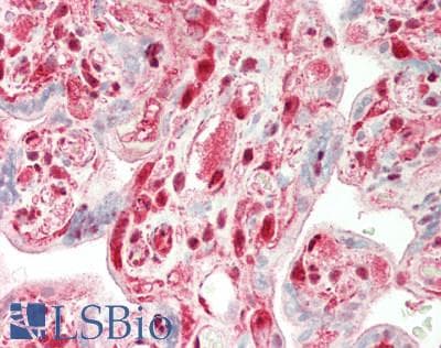 IHC-plus™ Polyclonal Rabbit anti-Human TPI1 / TPI Antibody (IHC, IF, WB)