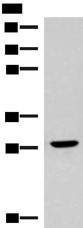 CLEC9A Antibody