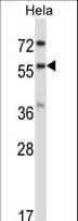RANGAP1 Antibody (aa20-49)