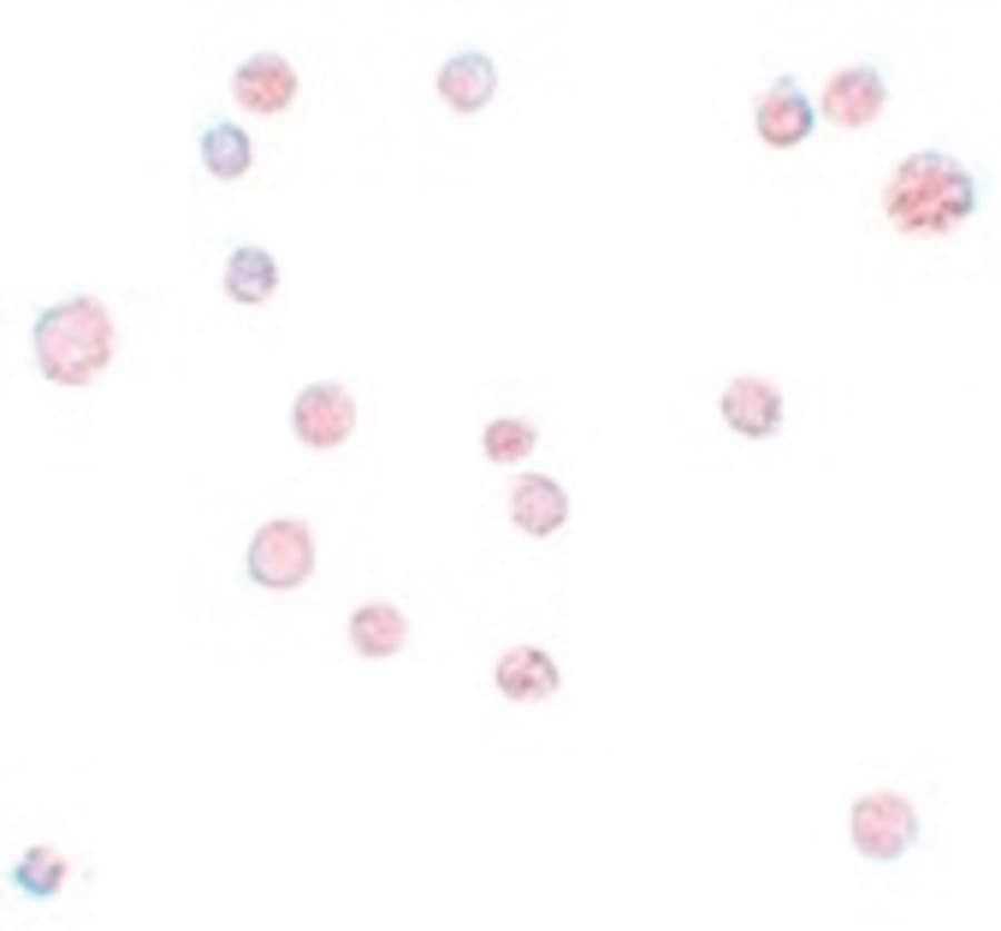 IHC-plus™ ATP11A Antibody