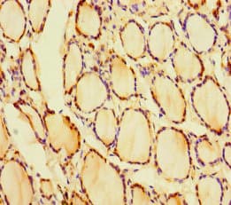 Polyclonal Rabbit anti-Human CRYGN Antibody