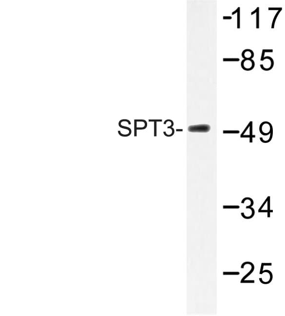 SPT3 / SUPT3H Antibody (Glu203)