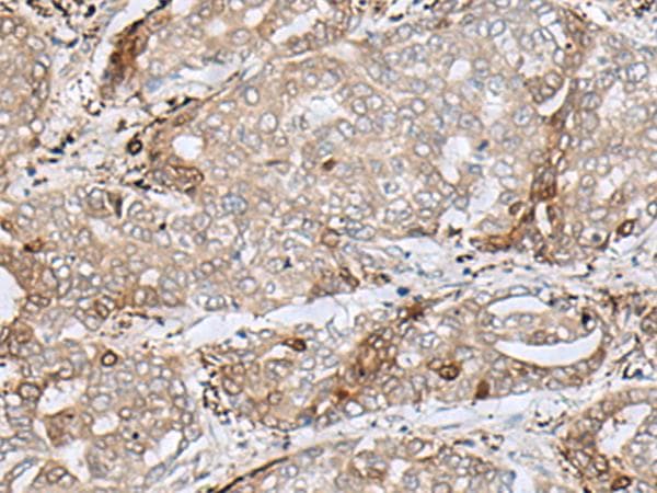 Polyclonal Rabbit anti-Human MRM1 Antibody (IHC, WB)